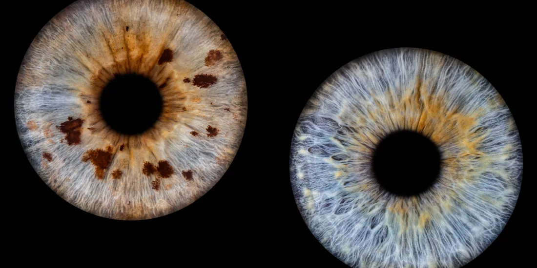 Zwei Iriden · Naturtöne – Irisfotografie als Wandbild von JALES – feine Motive
