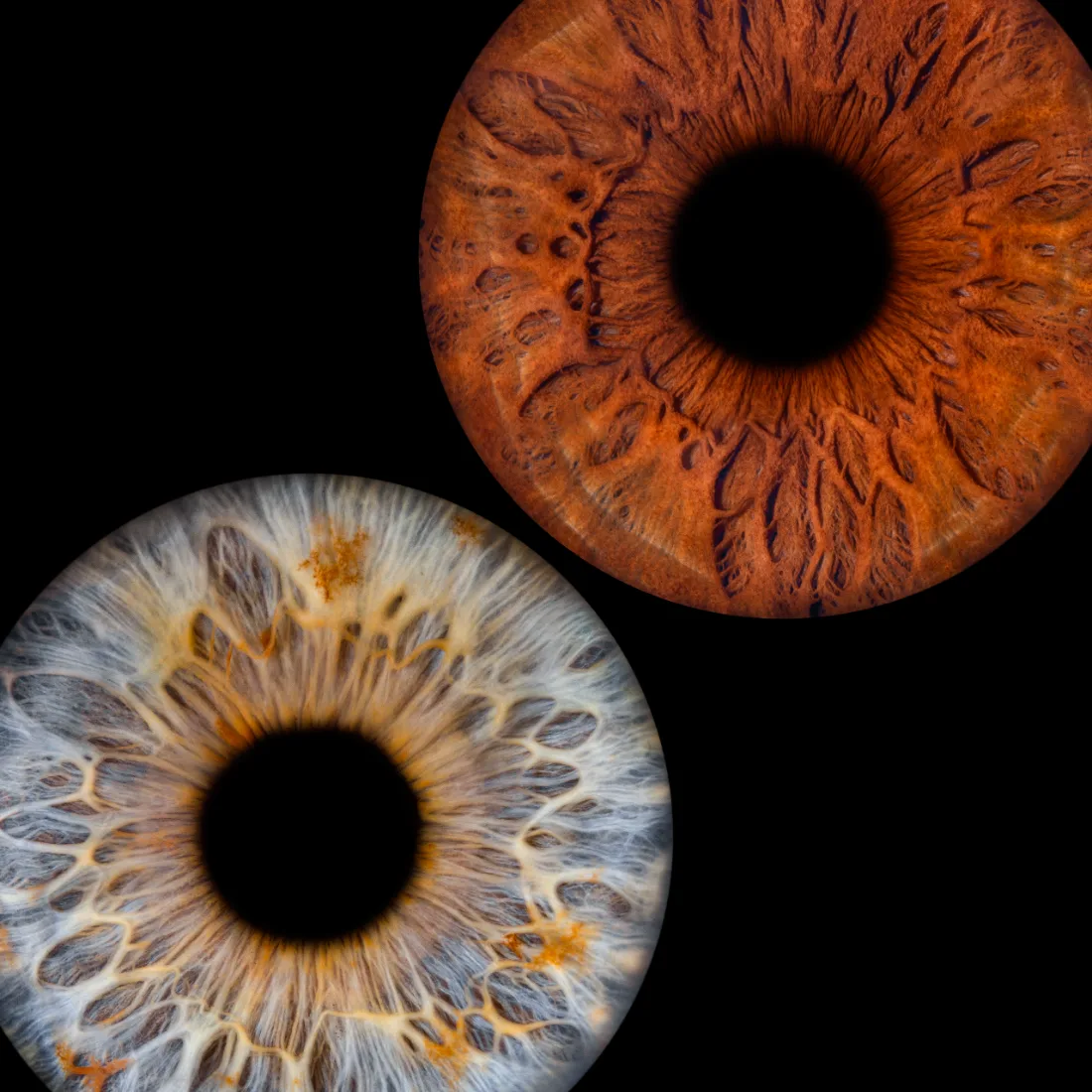 Zwei Iriden · Quadrat – Irisfotografie als Wandbild von JALES – feine Motive